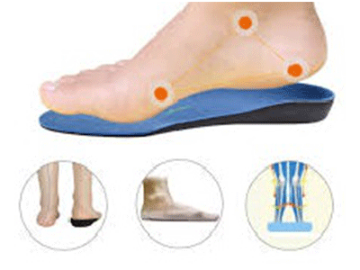How to Treat and Prevent Flat Feet